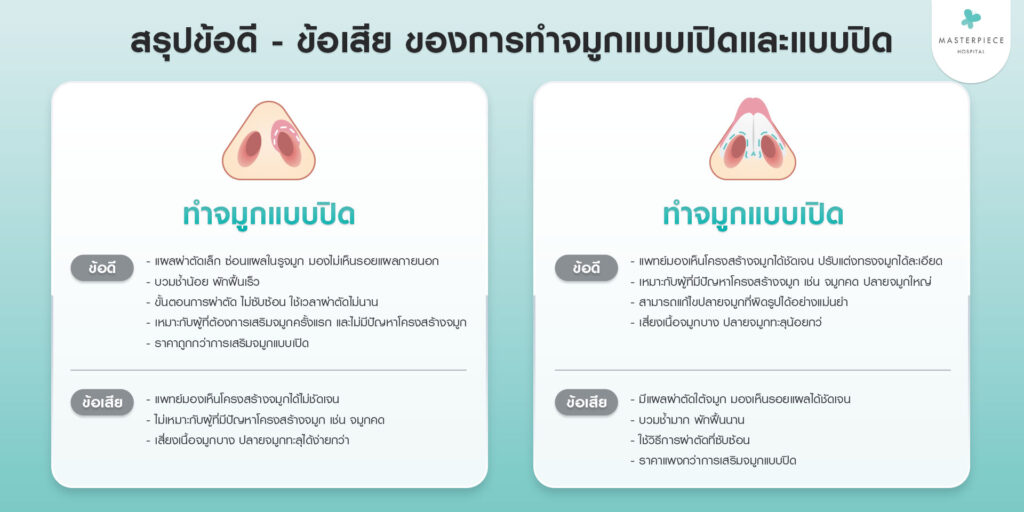 สรุปข้อดี---ข้อเสีย-ของการทำจมูกแบบเปิดและแบบปิด