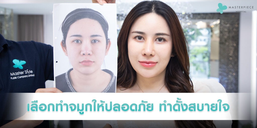 เลือกทำจมูกให้ปลอดภัย-ทำดั้งสบายใจ