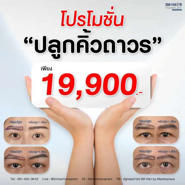 โปรโมชั่นปลูกคิ้ว โรงพยาบาลมาสเตอร์พีช
