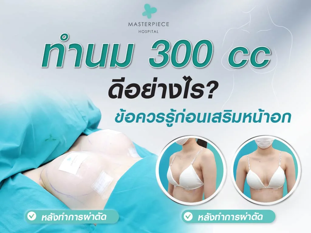 ทำนม 300 cc ดีอย่างไร?ข้อควรรู้ก่อนเสริมหน้าอก