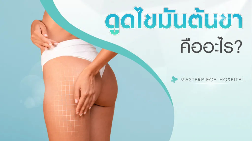 ดูดไขมันต้นขา (Thigh Liposuction) คือ 