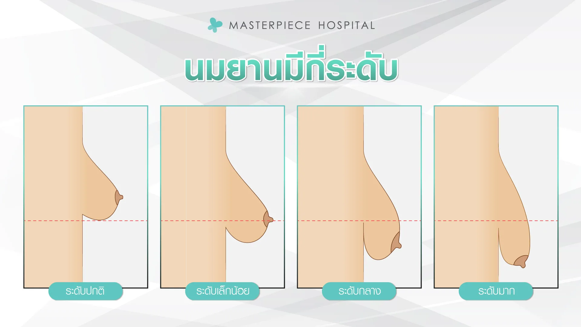 นมยานมีกี่ระดับ ระดับปกติ ระดับเล็กน้อย ระดับกลาง ระดับมาก