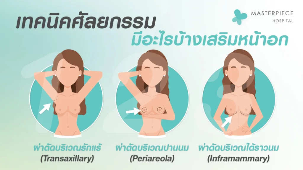 เทคนิคศัลยกรรมมีอะไรบ้างเสริมหน้าอก หมอไหนดี-01