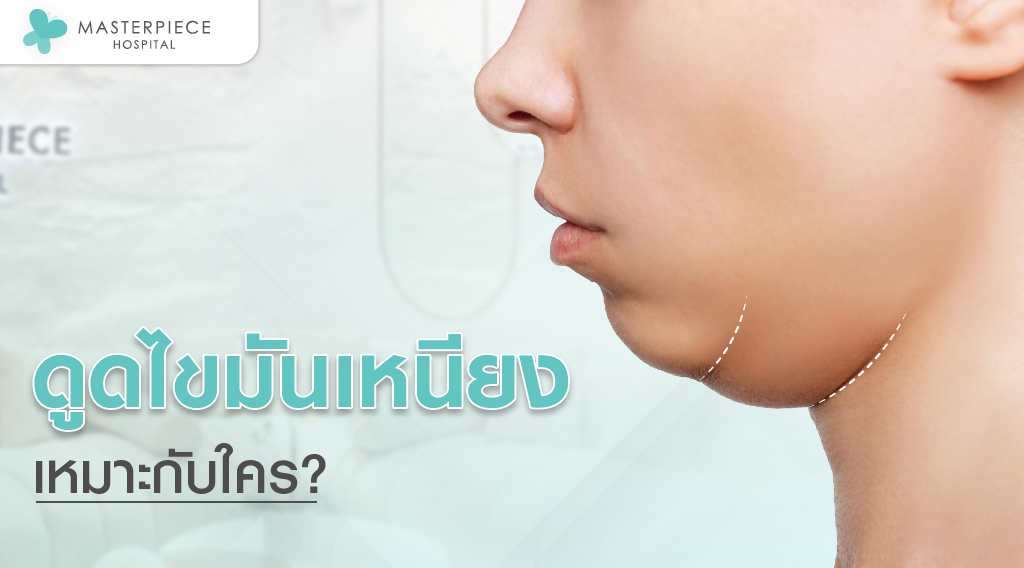 ดูดไขมันเหนียง เหมาะกับใคร?