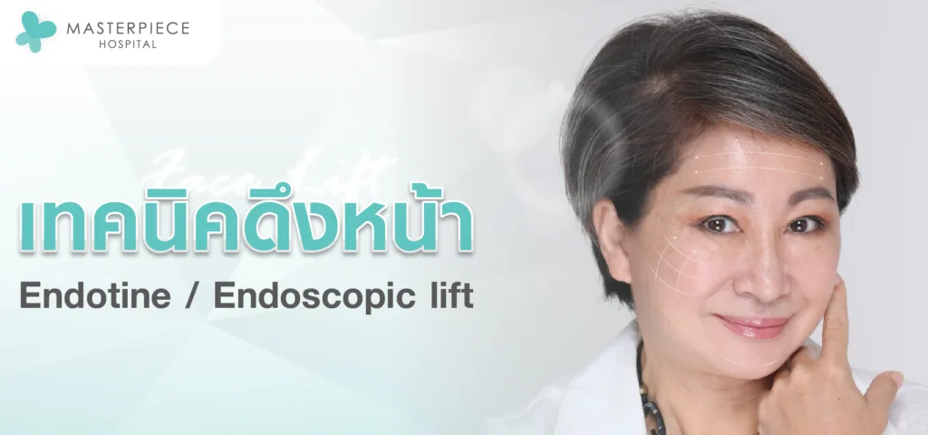 เทคนิคดึงหน้า endotine endoscopic lift