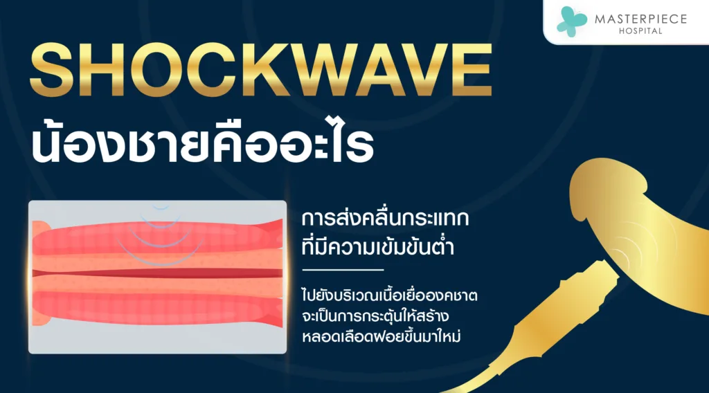 Shockwave น้องชายคืออะไร