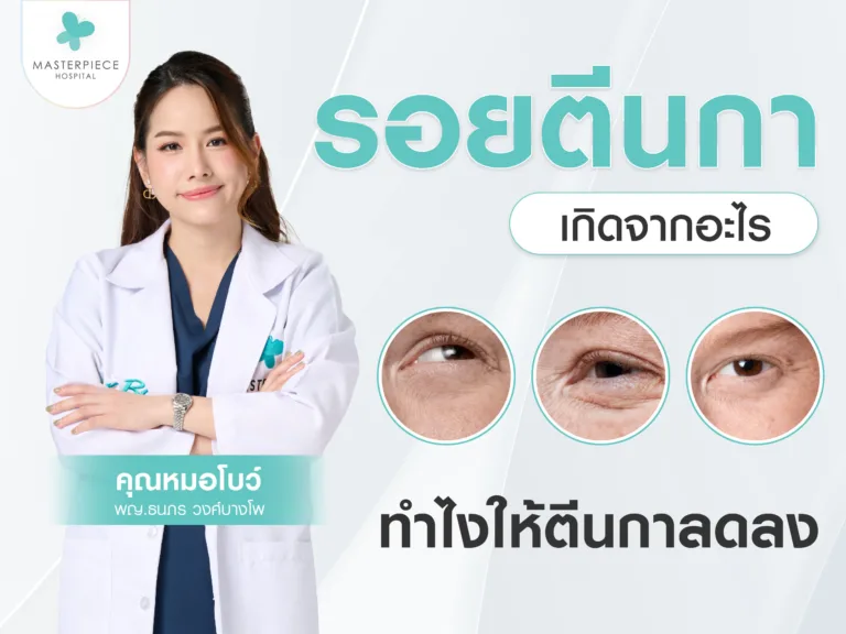 รอยตีนกา เกิดจากอะไร ทำยังไงให้ตีนกาลดลง