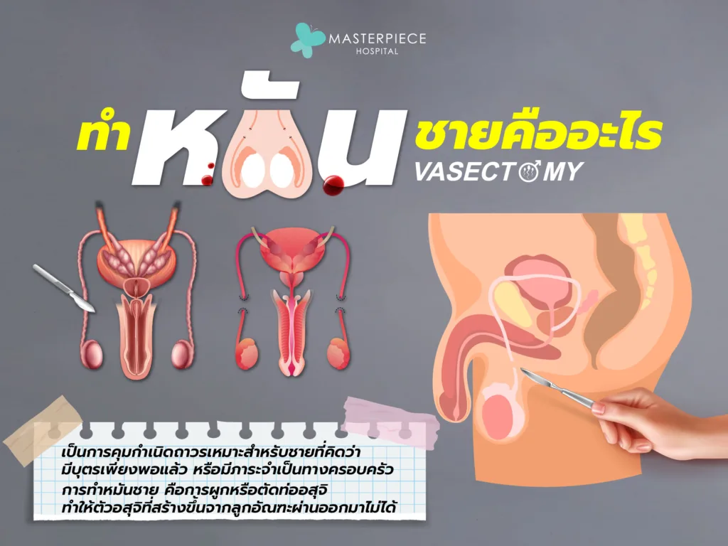 malesterilization2-01