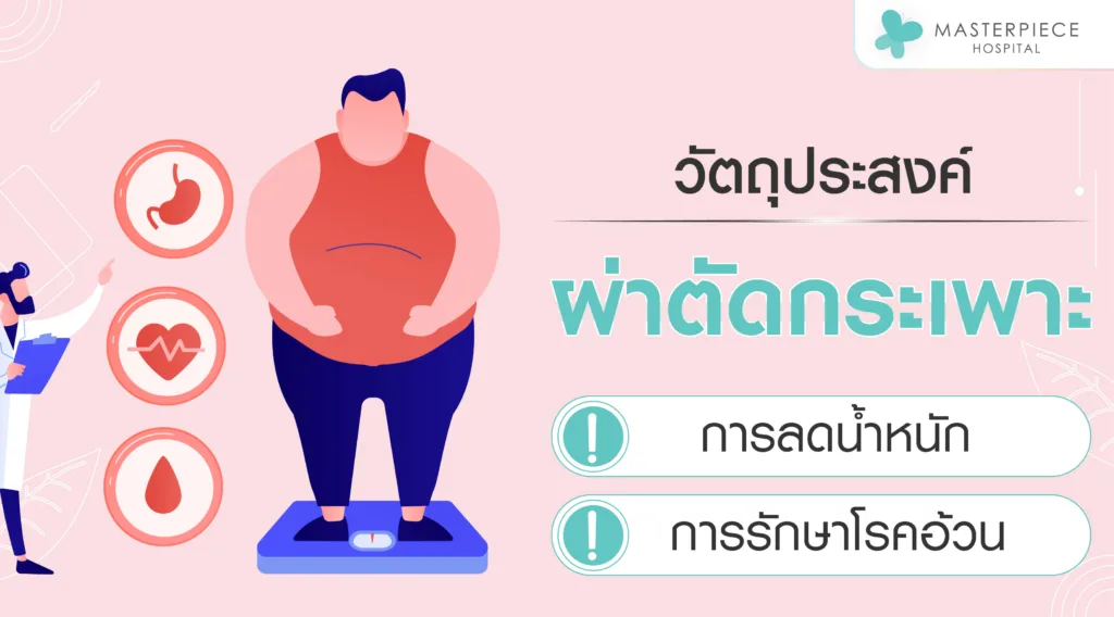 วัตถุประสงค์ของการผ่าตัดกระเพาะอาหาร