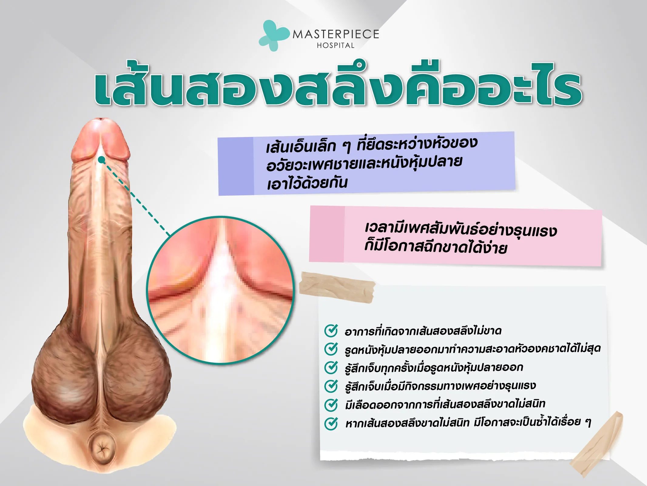 เส้นสองสลึงคืออะไร