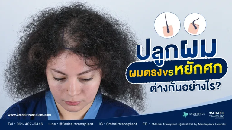 การปลูกผมตรง กับ การปลูกผมหยักศก เส้นผมแบบไหนก็ปลูกผมได้