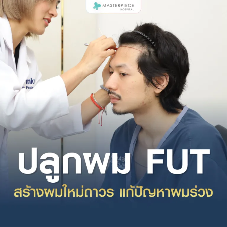 ปลูกผม FUT