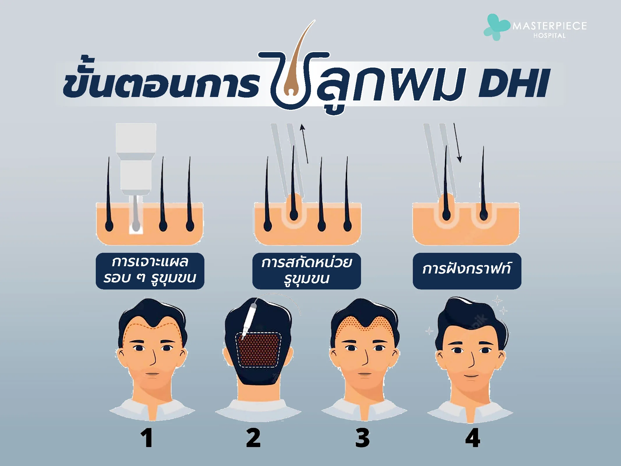 เปรียบเทียบ DHI กับเทคนิคปลูกผมอื่นๆ