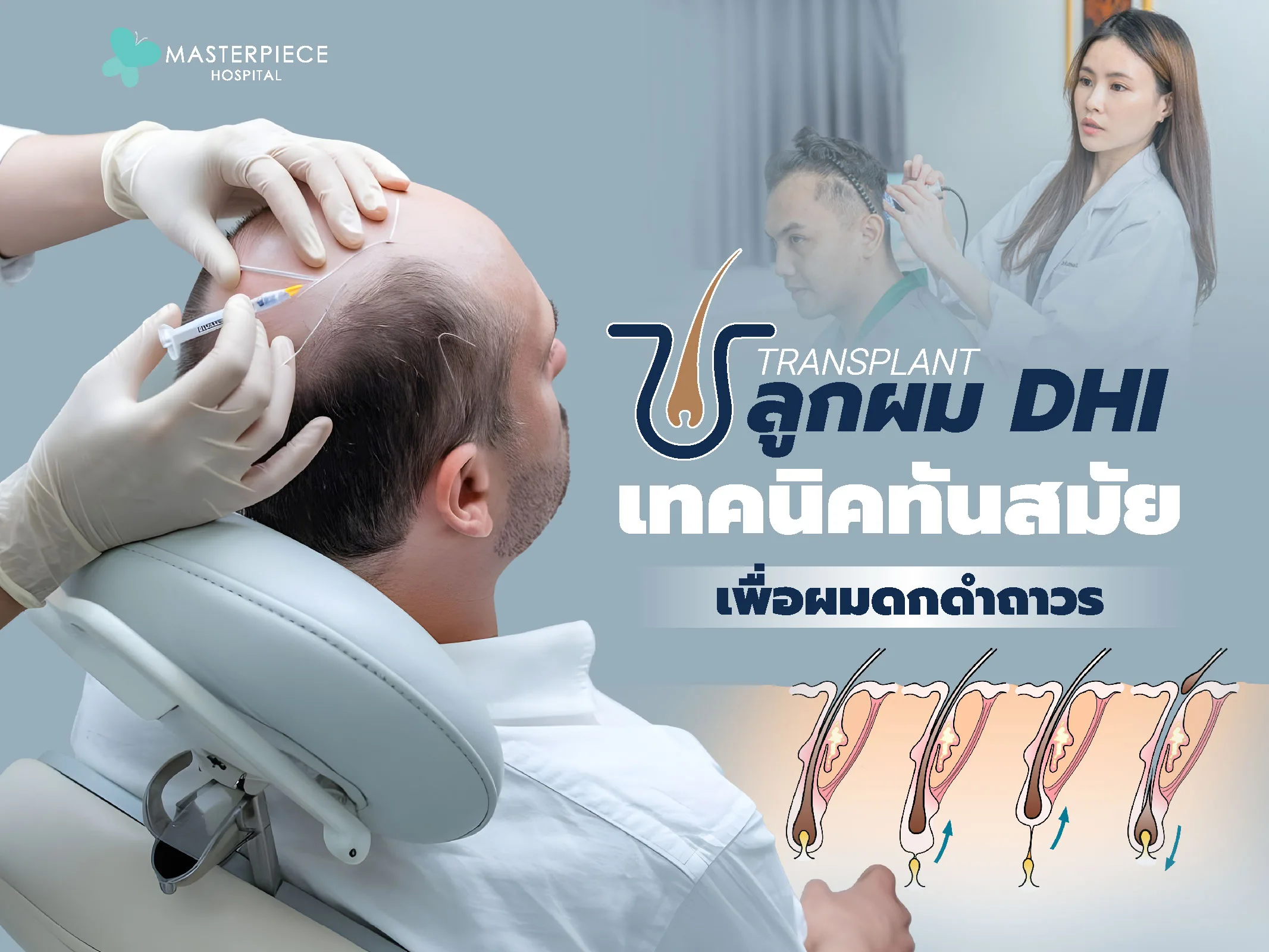 ปลูกผม DHI เทคนิคทันสมัยเพื่อผมดกดำถาวร