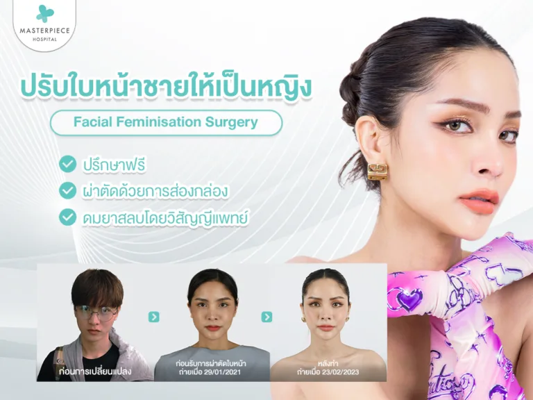 การผ่าตัดตกแต่งใบหน้าให้ดูเป็นผู้หญิง (Facial Feminization Surgery : FFS)