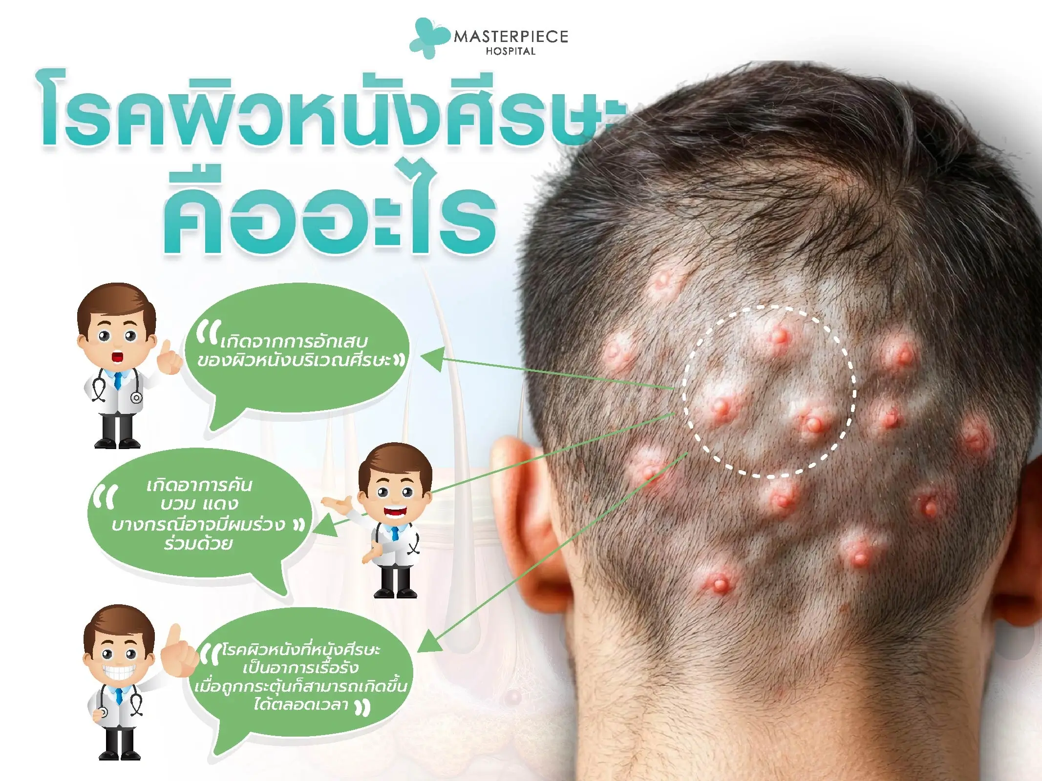 โรคผิวหนังที่หนังศีรษะคืออะไร?