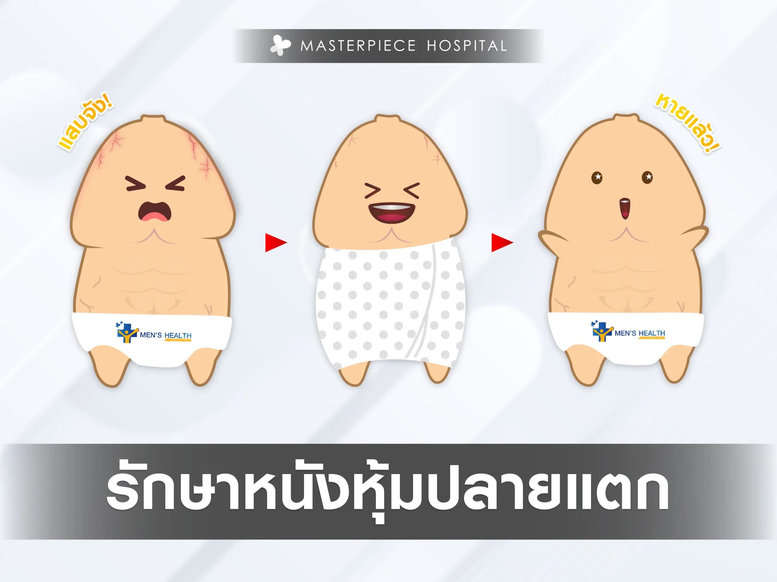 การรักษาหนังหุ้มปลายแตก