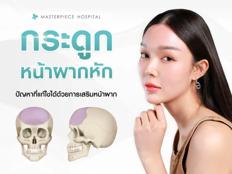 กระดูกหน้าผากหักหรือผิดรูป ปัญหาที่แก้ไขได้ด้วยการเสริมหน้าผาก