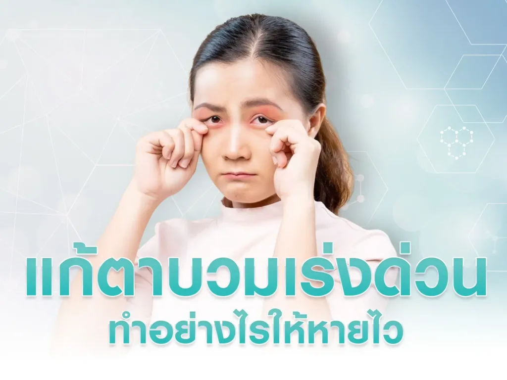 แก้ตาบวมเร่งด่วน ทำอย่างไรให้หายไว ให้มองไม่ออกว่าตาบวมมา