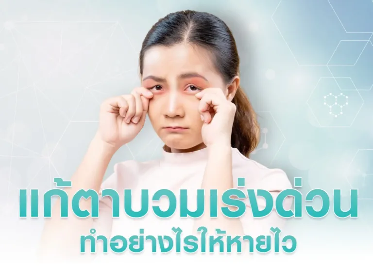 แก้ตาบวมเร่งด่วน ทำอย่างไรให้หายไว ให้มองไม่ออกว่าตาบวมมา