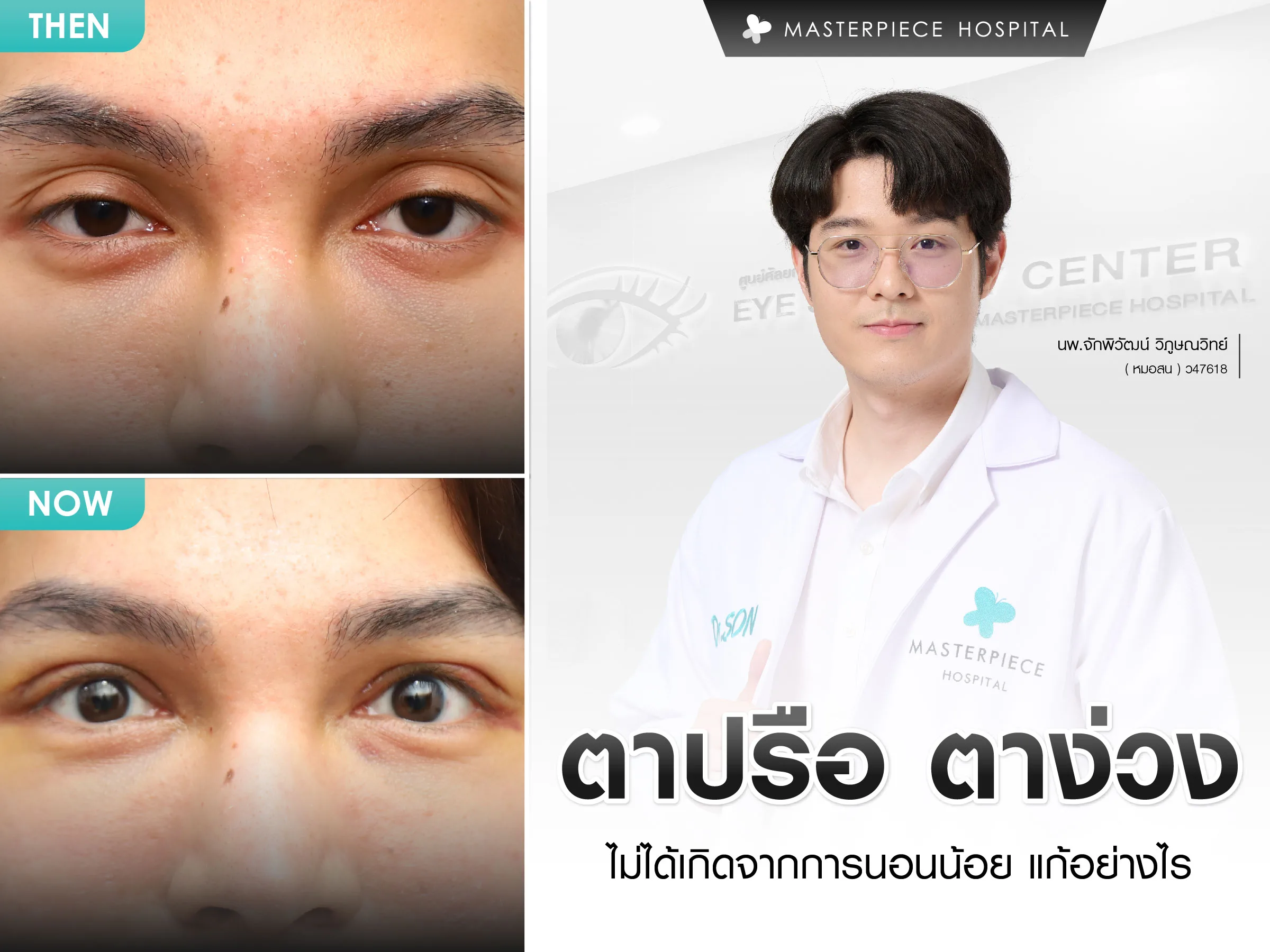 ตาปรือ