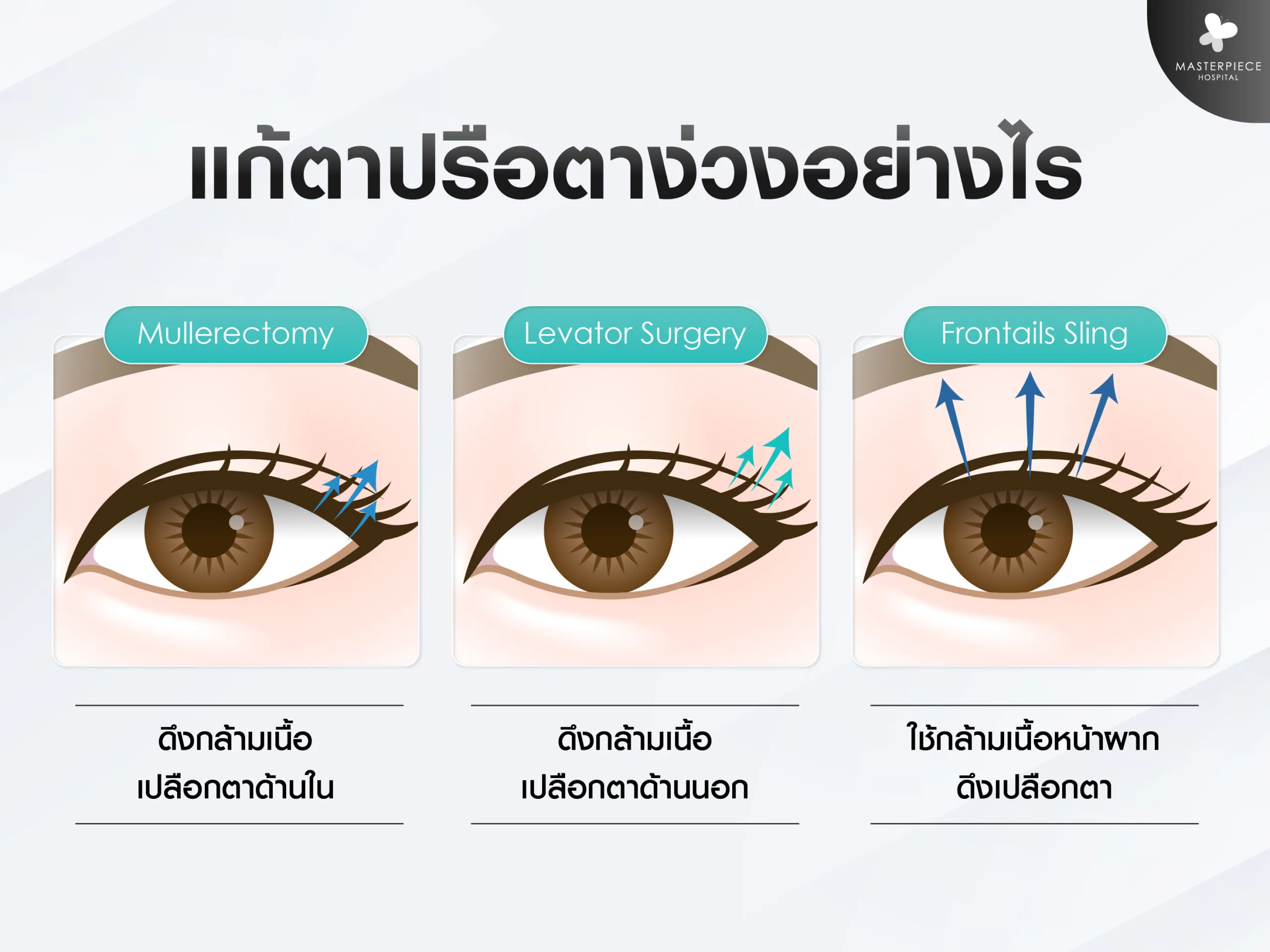 แก้ตาปรือ