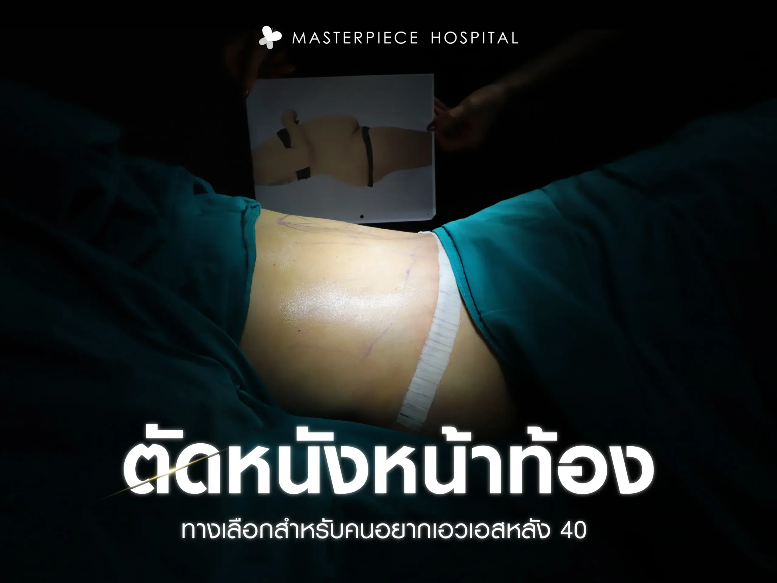‘ตัดหนังหน้าท้อง’ คืออะไร? ทางเลือกสำหรับคนอยากเอวเอสหลัง 40