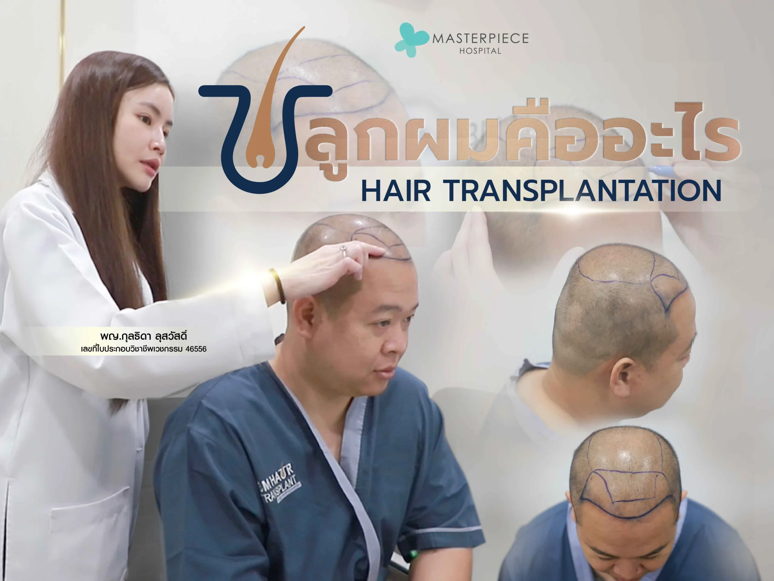 การปลูกผม (Hair Transplantation)