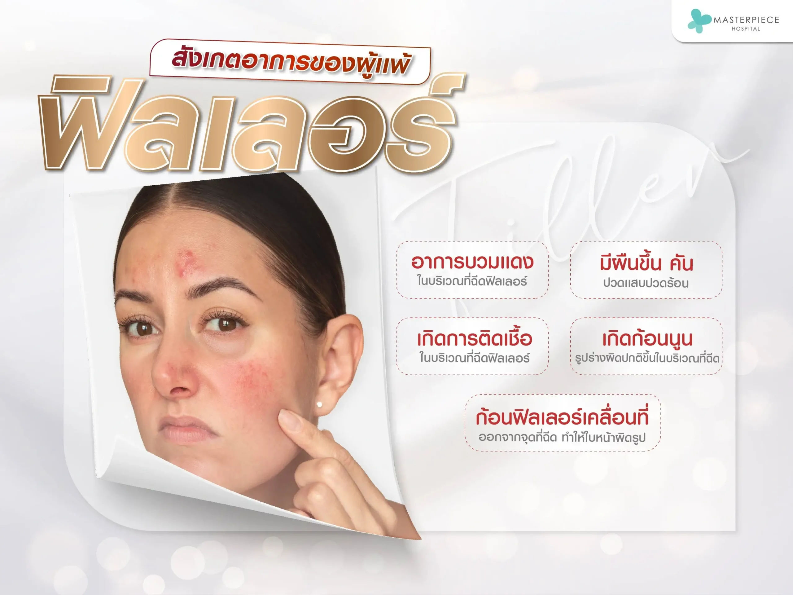 การแพ้ฟิลเลอร์