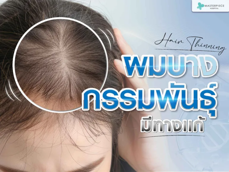 ผมบางกรรมพันธุ์ อย่าเพิ่งท้อ มีทางแก้